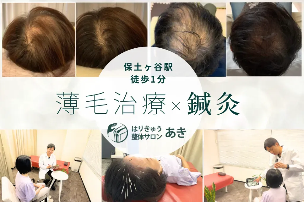 はりきゅう整体サロン　あき　薄毛・育毛鍼専門