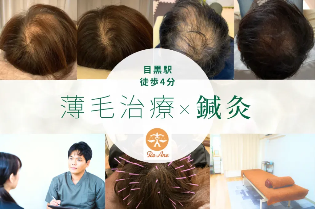 鍼灸整体院Re-Ane