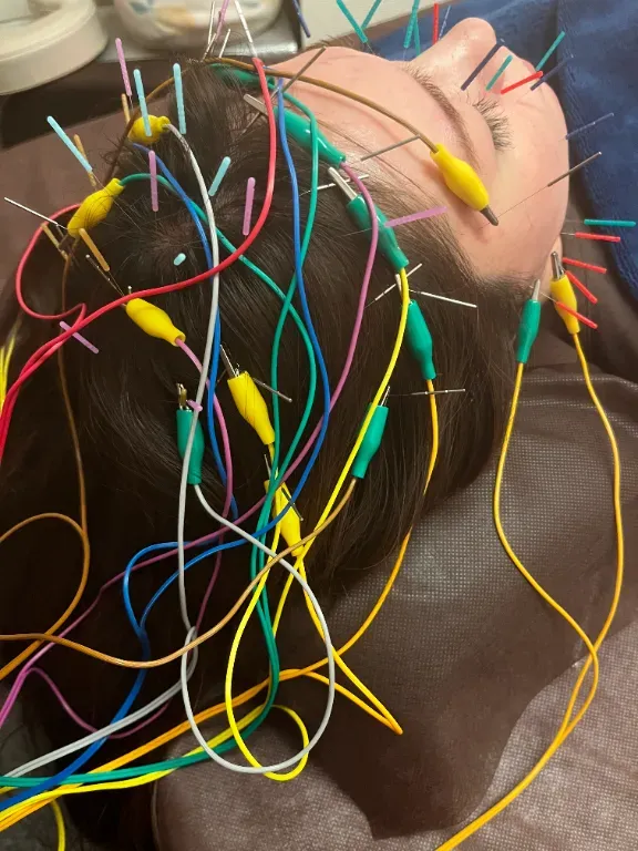 ハリのち晴れ鍼灸治療院　三鷹院