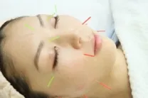 鍼灸院ラミン