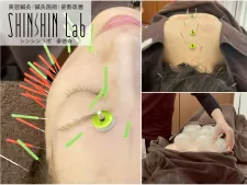 鍼灸サロン SHINSHIN Lab 豪徳寺