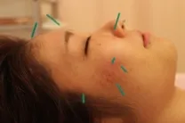 銀座鍼灸院メイリ