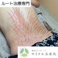 鍼灸マッサージ サイクル治療院