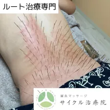 鍼灸マッサージ サイクル治療院