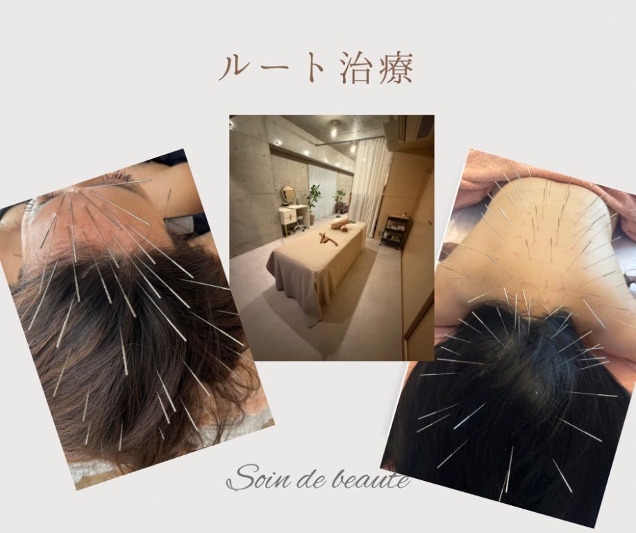 鍼灸soin de beaute
