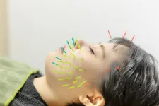 美容鍼灸整体 HARIKA 東京 新宿店