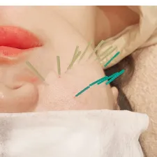 mielia美容鍼灸院