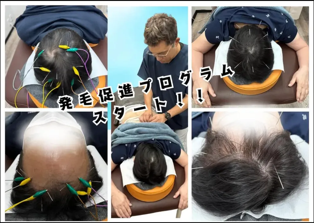 とらぐち鍼灸院