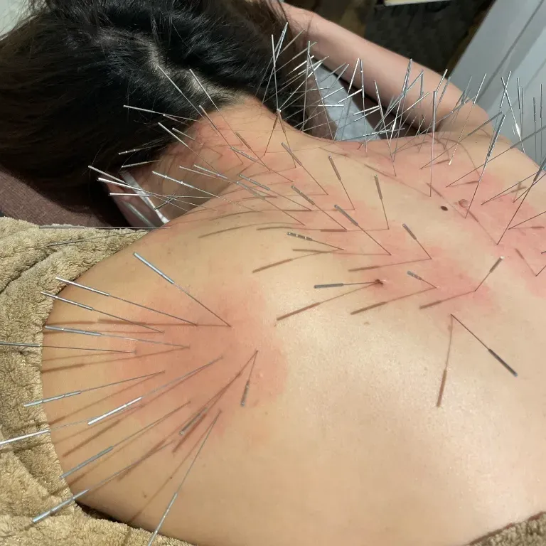 鍼処北風　飯田橋院