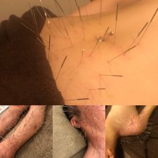 Iris鍼灸マッサージ上野院【ルート治療専門】