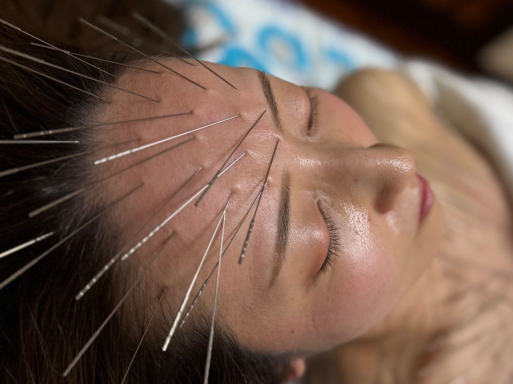 鍼灸かねこ【ルート治療専門院】