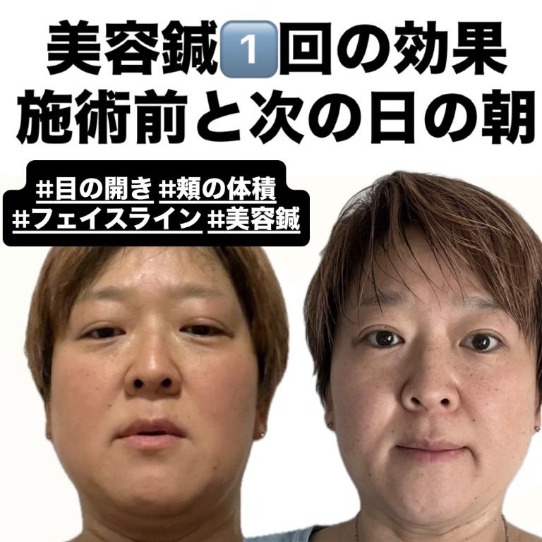 白山らくだ美容鍼灸整体院西巣鴨店～ 土・祝日営業 ～ 池袋駅板橋駅巣鴨駅から徒歩圏内