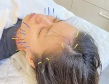 はりきゅうsalon TOTONOE