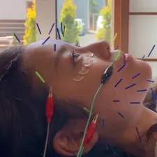美鍼堂