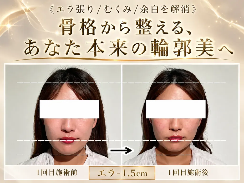 小顔矯正・美容鍼灸salon　Yusaku
