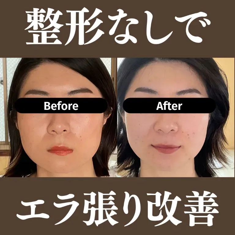 美容鍼灸サロン〜MIYABI〜