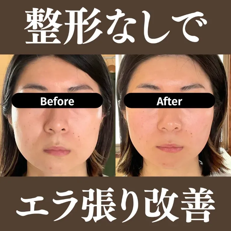 美容鍼灸サロン〜MIYABI〜