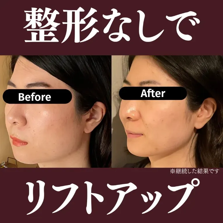 美容鍼灸サロン〜MIYABI〜