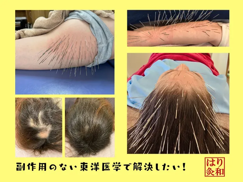 はりきゅう和