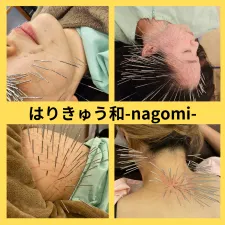 はりきゅう和