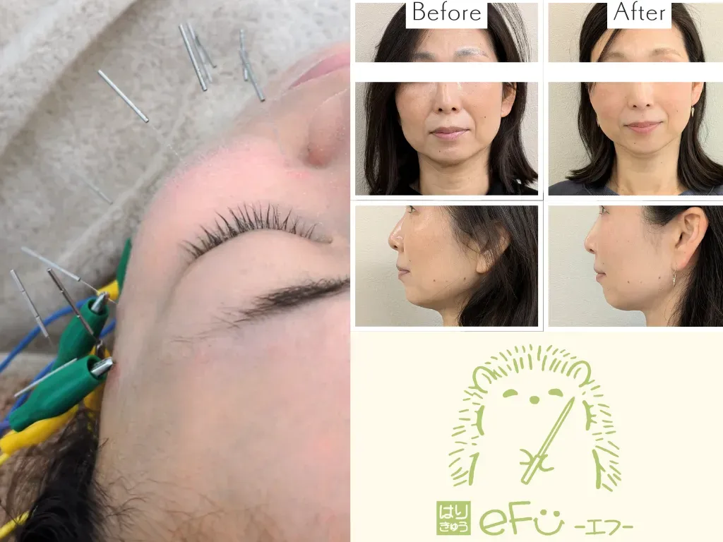 はりきゅうeFu -エフ-