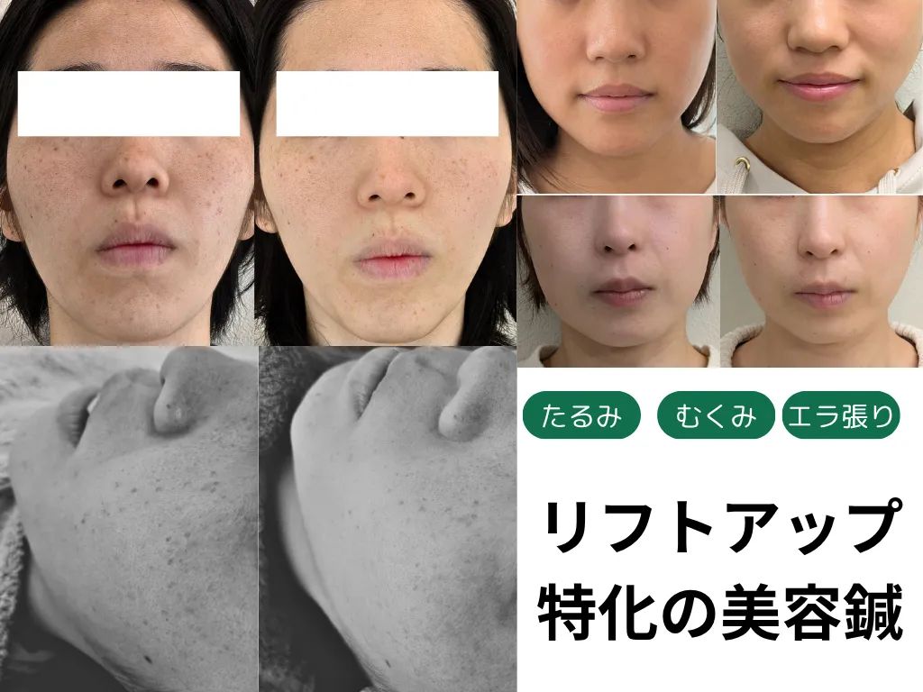 はりきゅうeFu -エフ-