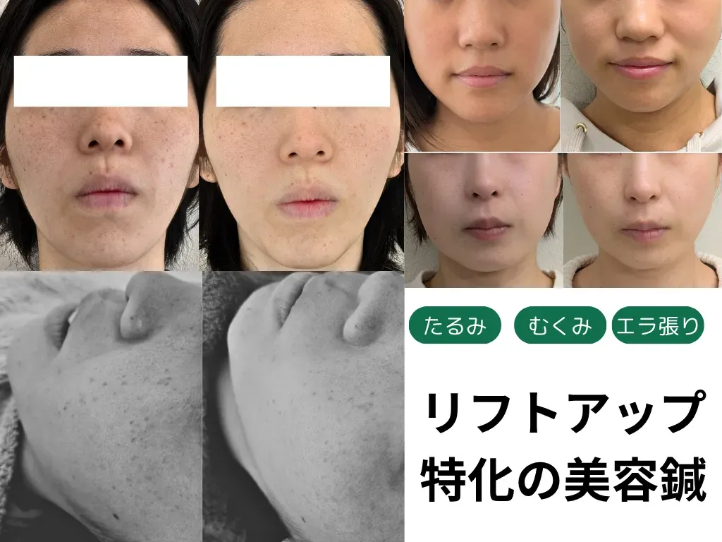 はりきゅうeFu -エフ-