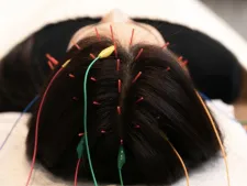 あたまの再起動【睡眠専門鍼灸サロン】