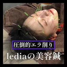 美容鍼 ledia(ルディア)堂島店