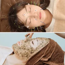 ✨Mercury鍼灸サロン✨ 美容専門