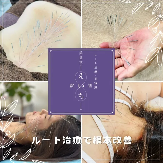 美身堂えいち鍼灸院 〜ルート治療・美容鍼〜