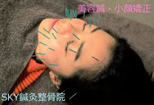 SKY鍼灸整骨院