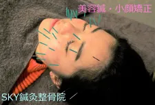SKY鍼灸整骨院