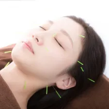 美容鍼サロン Perfetta