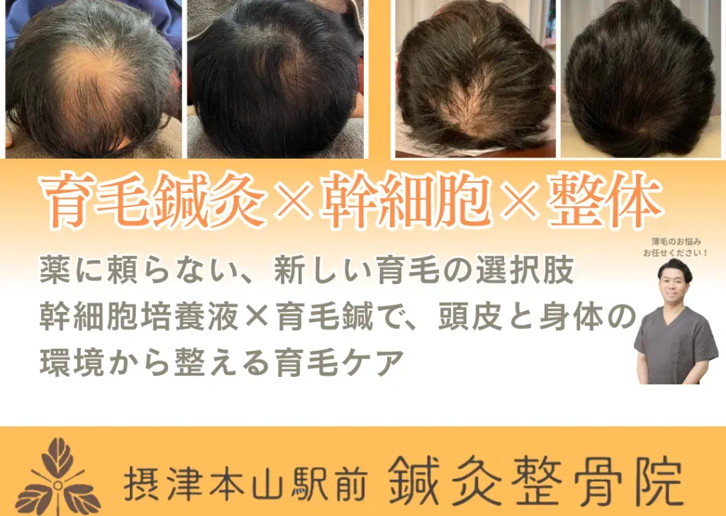 摂津本山駅前鍼灸整骨院