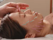 green鍼灸整体院(美容鍼と整体の専門院)