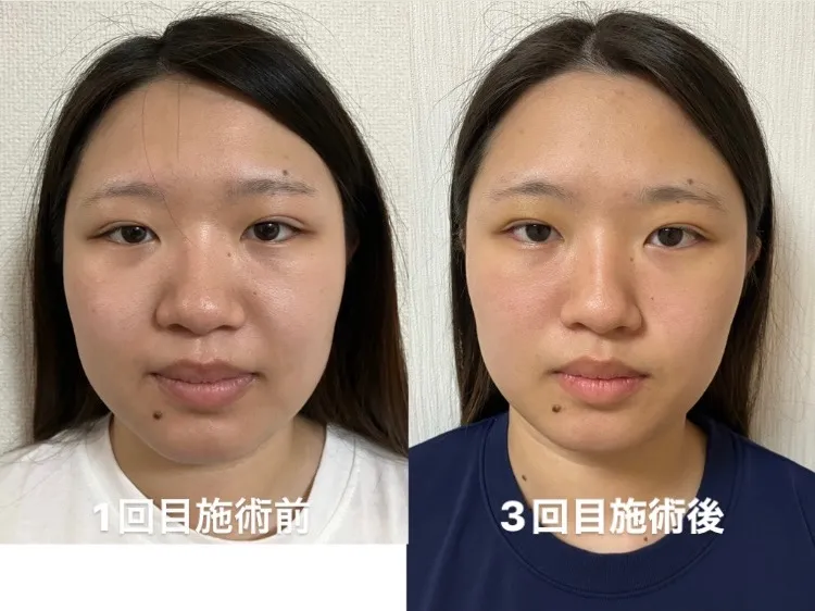 鍼秋田別院〜ルート治療専門院〜