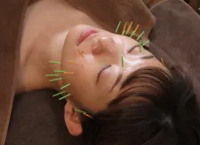鍼灸サロン Aculing