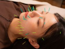 【美容鍼に特化】Entluce.鍼灸サロン