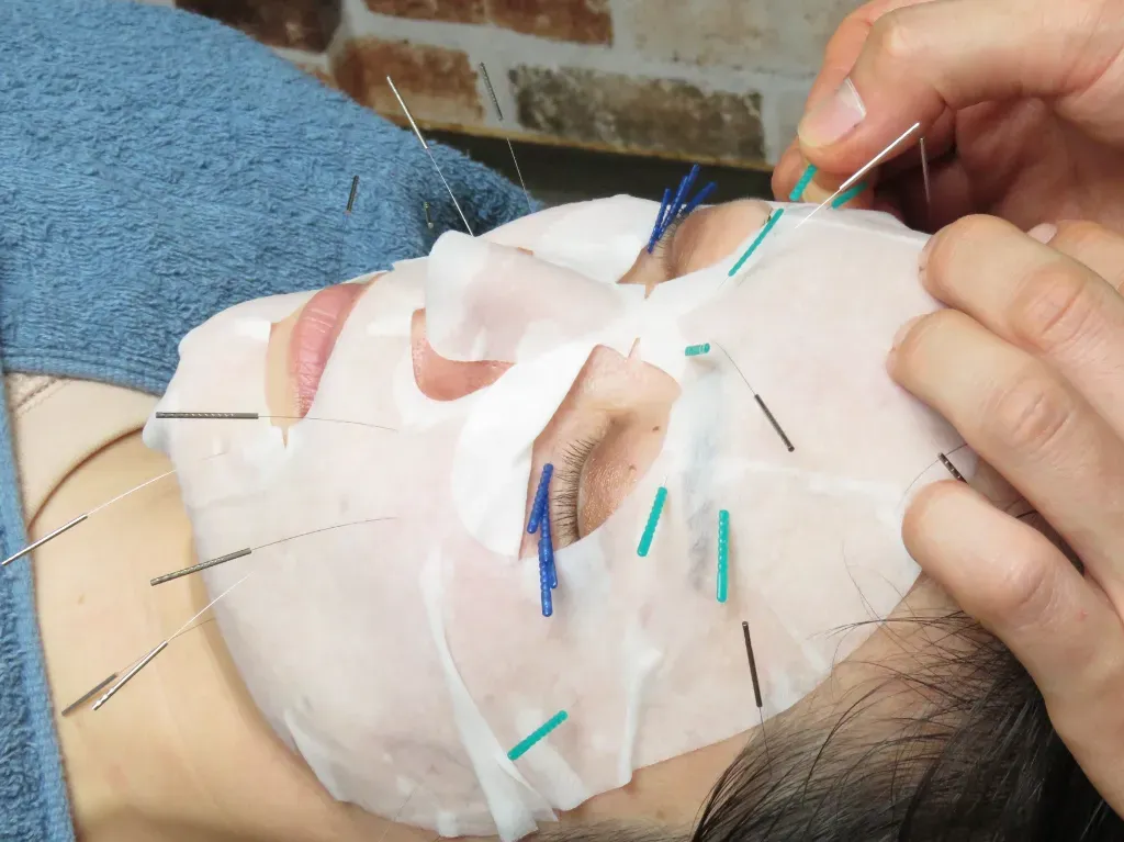 ほぐして コリとる鍼灸整体サロン