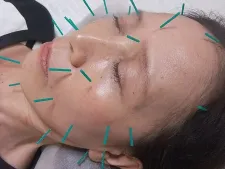 しげ鍼灸院