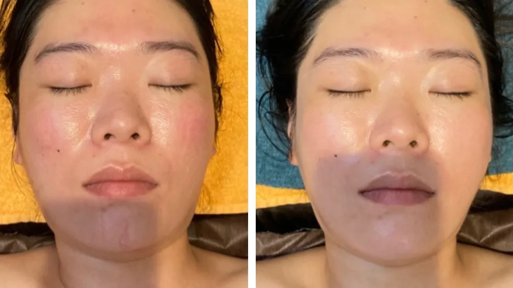 鍼灸ハウス　Ecure(エキュレ)