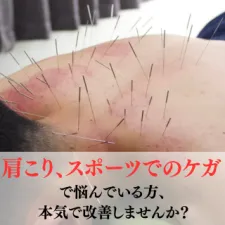肩こり・スポーツによるケガ他全ての症状可能 act新開鍼灸院|ルート治療認定院