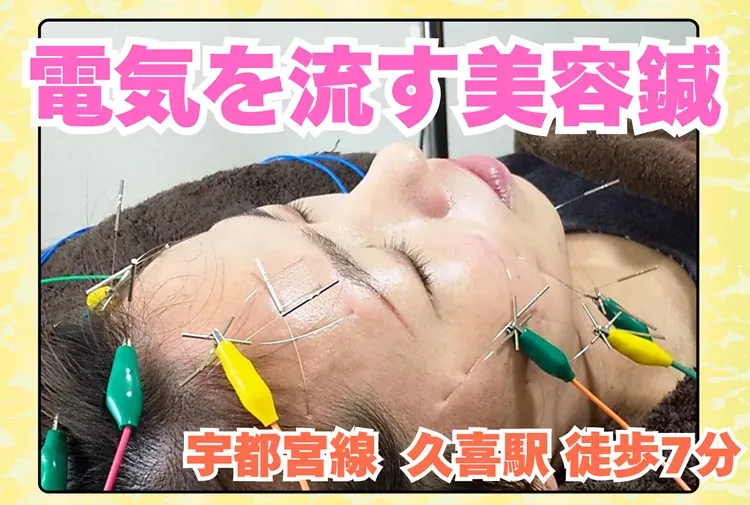 美容鍼専門サロン 飛船 (ひふね)
