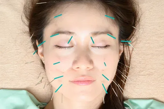 はり灸院こうえい