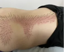 鍼処KEN