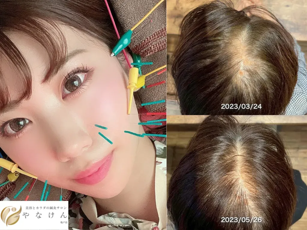 美容とカラダの鍼灸サロン やなけん 亀戸店
