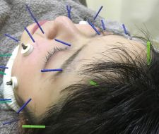 しょう鍼灸整骨院