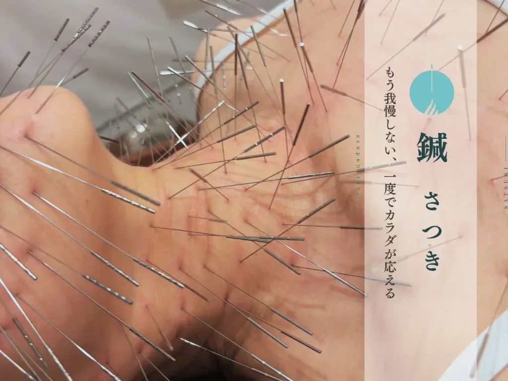 鍼さつき