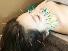 アキュリードkobe女性専用鍼灸サロン